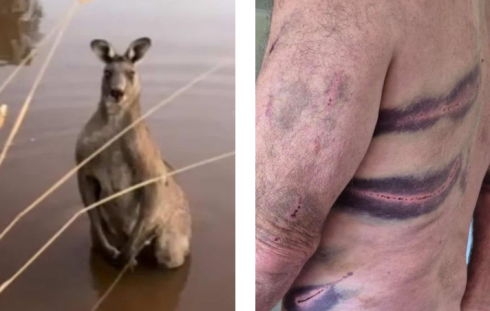 Australia, un uomo ha rischiato di morire dopo essere stato "frustato" selvaggiamente da un canguro