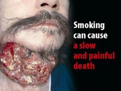 danni alla salute da fumo