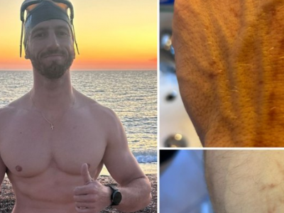 Un uomo &egrave; stato attaccato da uno squalo pinna nera durante le sue vacanze in Sardegna