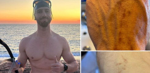 Un uomo è stato attaccato da uno squalo pinna nera durante le sue vacanze in Sardegna