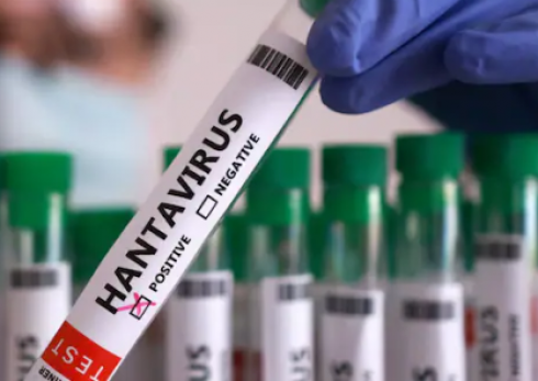 Gli scienziati hanno scoperto che l'hantavirus può persistere nello sperma degli uomini per sei anni dopo l'infezione