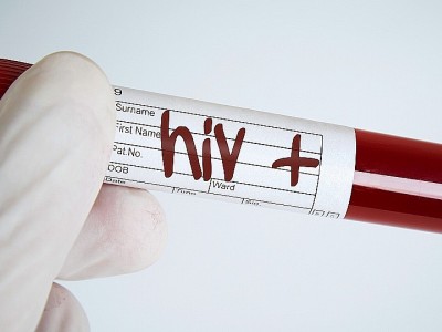 hiv