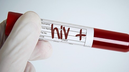 hiv hiv