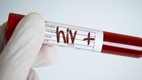 hiv