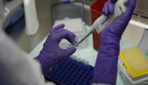 La Serratia, il batterio sul sapone ospedaliero contaminato per medici e infermieri che ha ucciso una neonata in ospedale.
