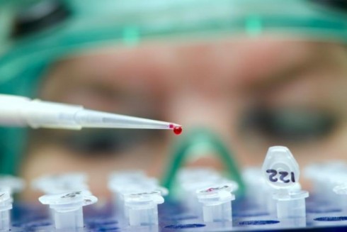 analisi sangue analisi sangue
