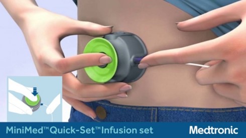 medtronic medtronic
