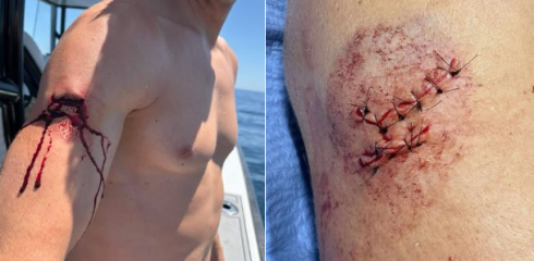 Ennesimi attacchi di squalo nelle acque della Pensacola in Florida