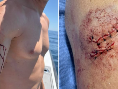 Ennesimi attacchi di squalo nelle acque della Pensacola in Florida