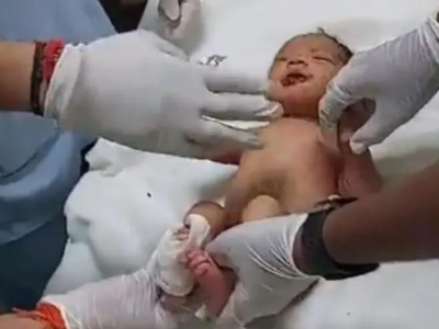 India: neonato trovato vivo in uno scarico, i ratti gli avevano mangiato le labbra e le dita – Il video