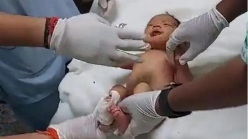 India: neonato trovato vivo in uno scarico, i ratti gli avevano mangiato le labbra e le dita – Il video