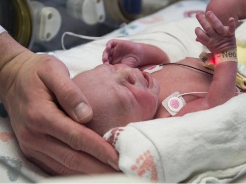 neonato neonato