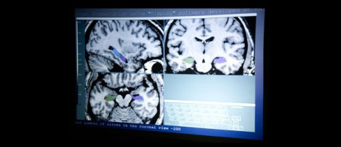 neuroimmaging neuroimmaging