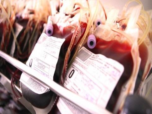 plasma plasma