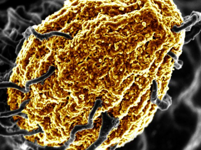 È in fase di sperimentazione una proteina che mangia le cellule nocive che ci fanno ammalare