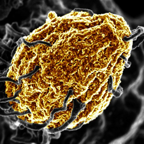È in fase di sperimentazione una proteina che mangia le cellule nocive che ci fanno ammalare