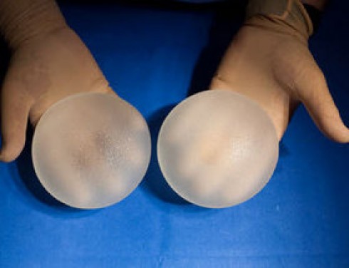 Protesi mammarie ritirate in Francia per rischio tumore