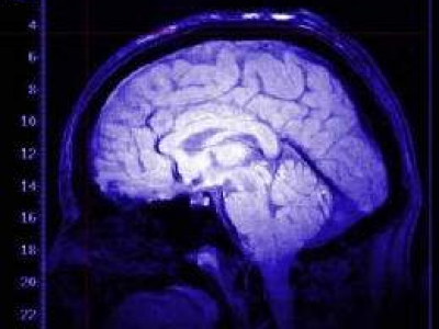Coscienza nascosta: i ricercatori scoprono una misteriosa attività cerebrale nei morenti