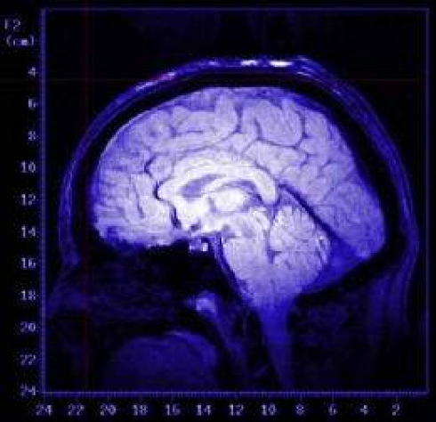 Coscienza nascosta: i ricercatori scoprono una misteriosa attività cerebrale nei morenti