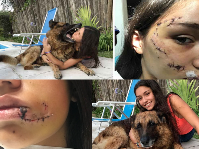 Selfie da "brivido" col cane finisce male: 17enne ferita gravemente a morsi