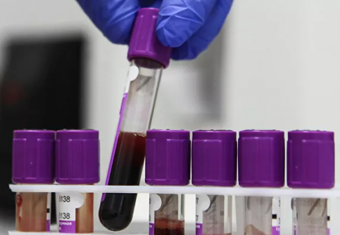Dalla Russia un farmaco per la cura del Covid-19.