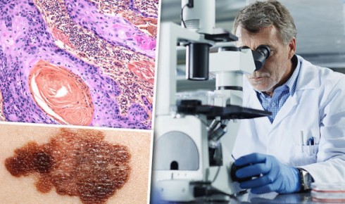 ricercatore cancro ricercatore cancro