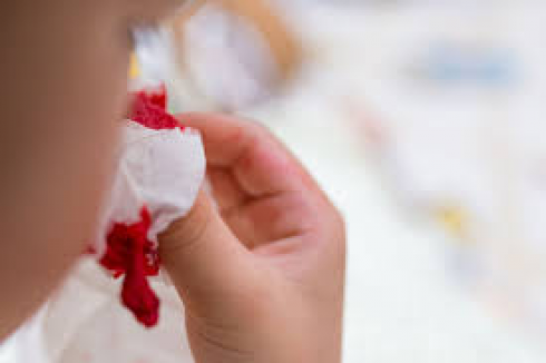 Ragazzo piange lacrime di sangue: i medici rimangono scioccati nello scoprire la causa