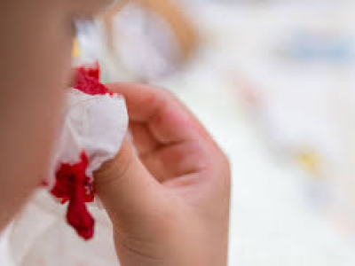 Ragazzo piange lacrime di sangue: i medici rimangono scioccati nello scoprire la causa