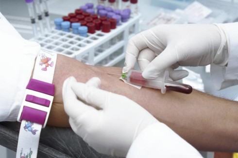 analisi sangue provette analisi sangue provette