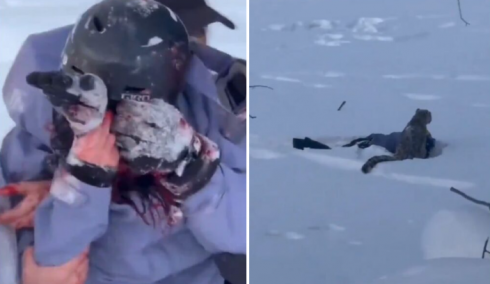 Selfie mania, ha rischiato la vita per la foto perfetta: leopardo delle nevi attacca una sciatrice