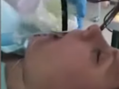 Salute: intervento record in Russia. Rimosso un serpente dall’esofago strisciato nella bocca di una donna