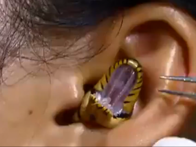 Il "chirurgo" tenta di rimuovere il serpente vivo dall'orecchio della donna – VIDEO