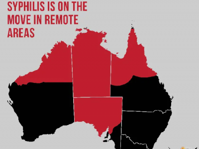 Antiche malattie ritornano? Un'epidemia di sifilide sarebbe la causa della morte di sette bambini in Australia. 