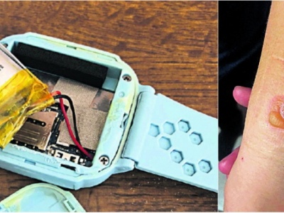 Tecnologia "esplosiva". Svizzera: smartwatch cinese ustiona il polso di un bambino. 