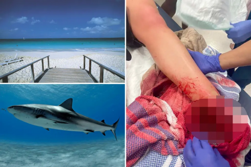 Squalo morde un bambino di 8 anni ferendolo gravemente in un attacco al largo della costa della Florida