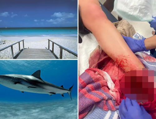 Squalo morde un bambino di 8 anni ferendolo gravemente in un attacco al largo della costa della Florida