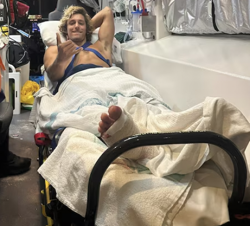 Un surfista uruguaiano di 20 anni sopravvive all'attacco di uno squalo in Australia grazie ai riflessi pronti
