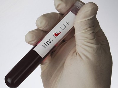 test  HIV