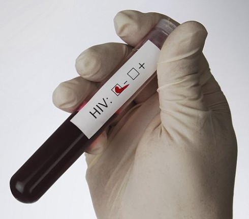 test HIV test HIV