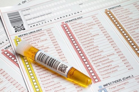 test urine test urine