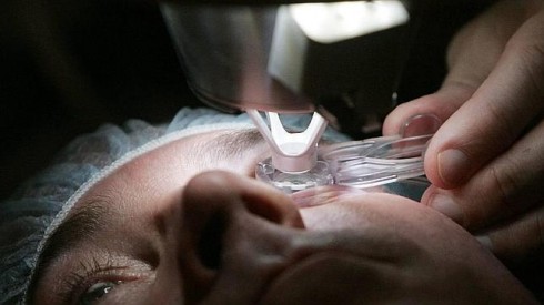 trapianto cornea trapianto cornea