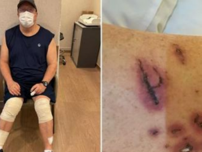 Singapore, un uomo è stato aggredito e ferito seriamente da una ventina di lontre in un parco