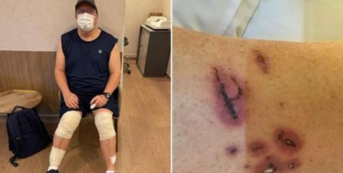 Singapore, un uomo è stato aggredito e ferito seriamente da una ventina di lontre in un parco