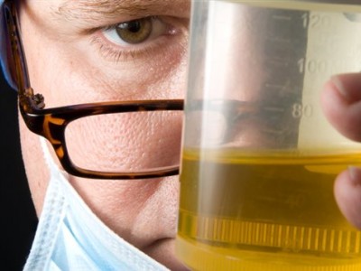 test urine