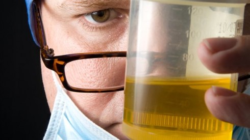 test urine test urine